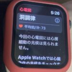 Apple Watch「心電図」機能　Series 4以降で正式対応 IMG_5779