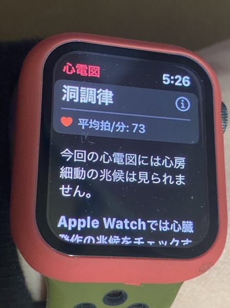 Apple Watch「心電図」機能 Series 4以降で正式対応 IMG_5779